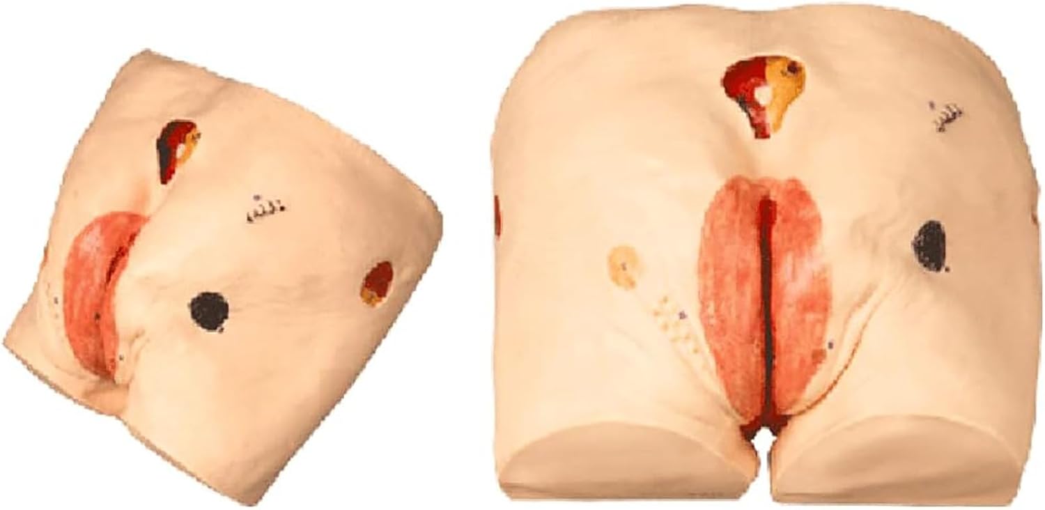Bedsore Nursing Human Model, Ulcers Nursing Model, Made of VC Plastic Casting Technology, Easy to Disassemble, Medical Teaching Human Simulator, Suitable for Nursing Teaching